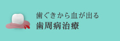 歯ぐきから血が出る歯周病治療