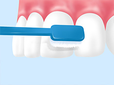 ブラッシング指導（TBI）